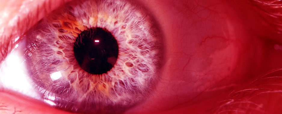 Rica erodes your right to privacy