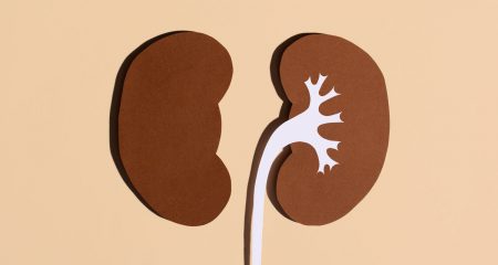 Surgeons make South African history with first robotic kidney donation