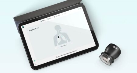 R85-million for SA start-up reinventing the stethoscope with AI