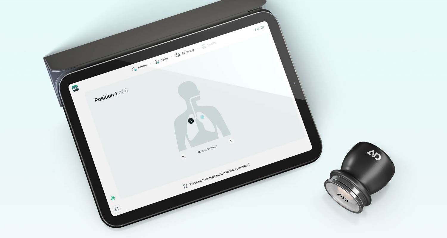 R85-million for SA start-up reinventing the stethoscope with AI