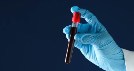 Ampath finds no evidence that test results were taken in breach