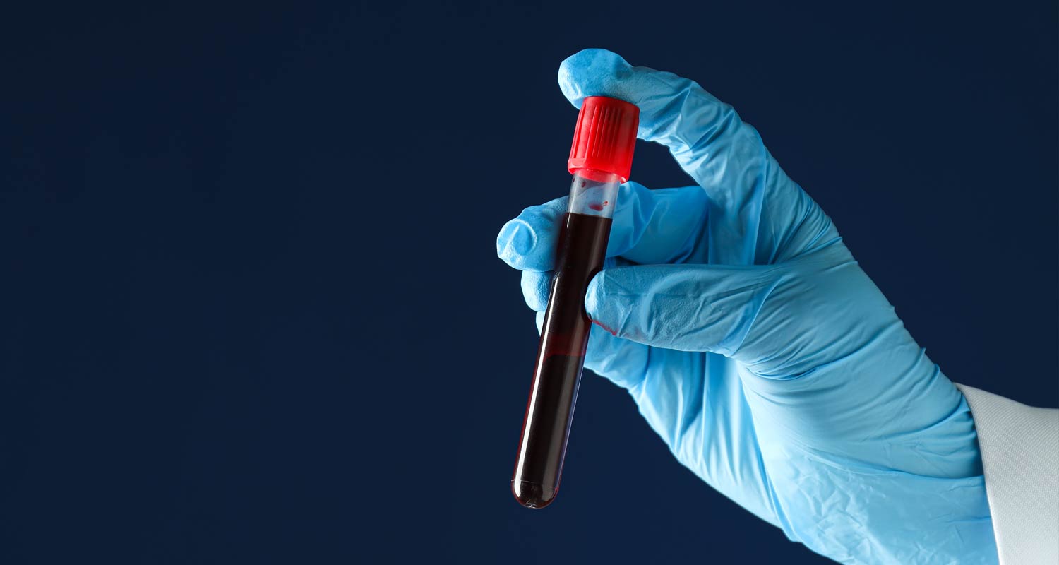 Ampath finds no evidence that test results were taken in breach